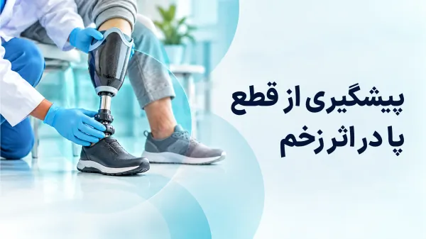 پیشگیری از قطع پا  در اثر زخم